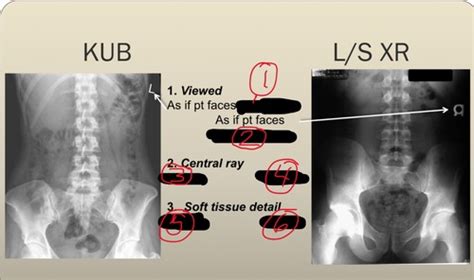 Radiology Of Abdomen Flashcards Quizlet