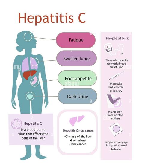 Hepatitis C MEDizzy