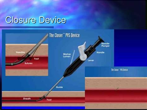 Ppt Brief History Of Cardiac Catheterisation Powerpoint Presentation