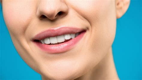 Anchorage Chipped Tooth Repair Chugach Dental