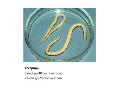 Гельминтозы. Аскаридоз - презентация онлайн