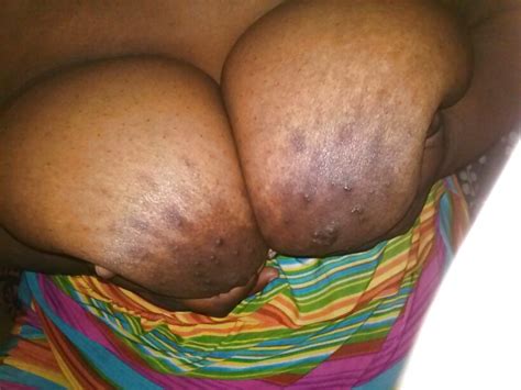 Blk Bbw Porn Pictures XXX Photos Sex Images PICTOA