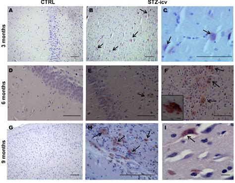 Ab 1-42 accumulation of in the brain of STZ-icv treated rats ... 