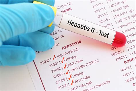 How Do I Get Tested For Hepatitis Bhbv