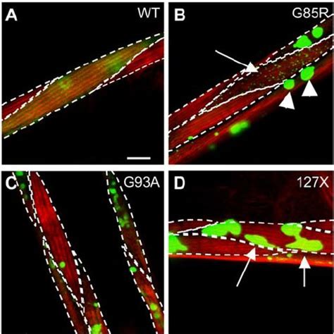 Mutant Sod Forms Morphologically Distinct Aggregates Projections Of