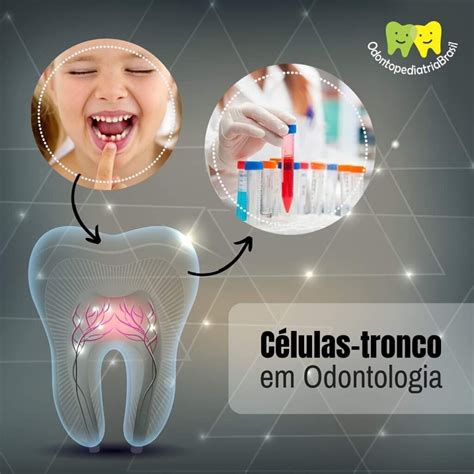 Dente De Leite Tamb M Tem C Lulas Tronco Odontopediatria Brasil