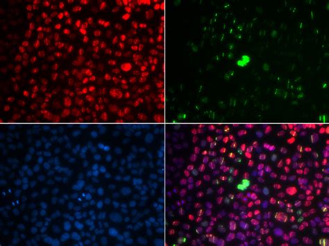 Anti Atm Antibody Rabbit Anti Human Polyclonal If Ihc Wb Lsbio