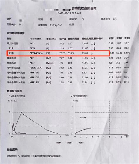 被延误20多年才确诊的慢阻肺病，他用四年时间逆转了！慢阻肺病抗争记（1） 知乎