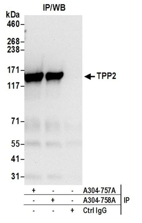 Tpp2 Polyclonal Antibody A304 758a T