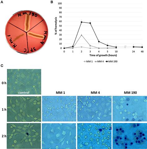 Frontiers Comparative Genome Analysis Of Uropathogenic Morganella