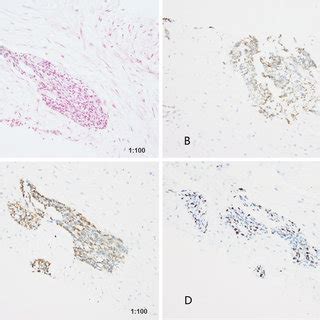 Histological And Immunohistochemistry Analysis Of The Intra Abdominal