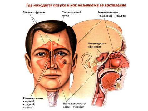 Может ли гайморит быть без насморка и и заложенности носа