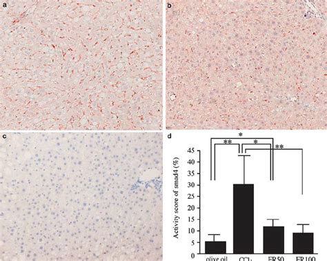 Representative Liver Sections Showing Immunohistochemical Expression Of