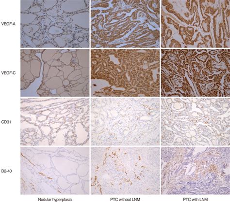 Vascular Endothelial Growth Factor Vegf Cd31 And D2 40 Expression Download Scientific