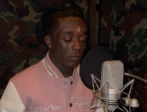 Lil Uzi Vert implants a $24 million diamond in his forehead