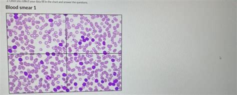 Solved Blood Smear Neutrophils Eosinophils Basophils Chegg