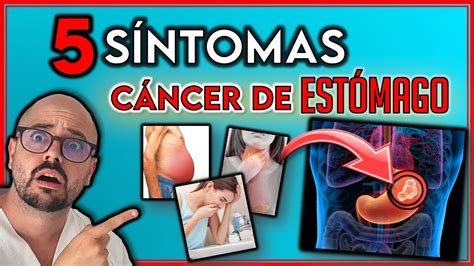 SÍNTOMAS que INDICAN un CÁNCER de ESTÓMAGO SÍNTOMAS que NO debes