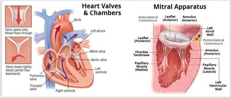 Basic anatomy of heart valves and chambers (mitral valve apparatus ...