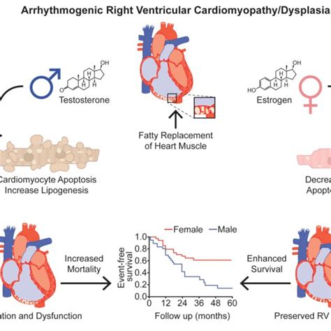 Effects Of Sex Hormones In Arrhythmogenic Right Ventricular