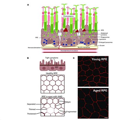 Schematic Of Changes That Occur In The Retinal Pigment Epithelium RPE