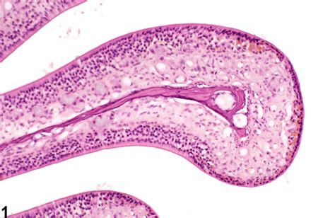 Nose Olfactory Epithelium Atrophy Nonneoplastic Lesion Atlas