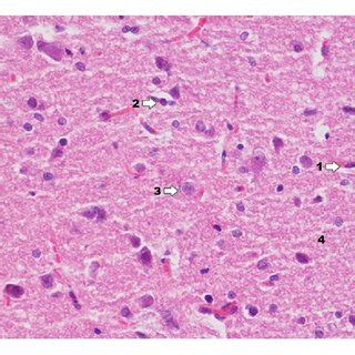 Histological image of hippocampus in animals in group C (enlargement ... 