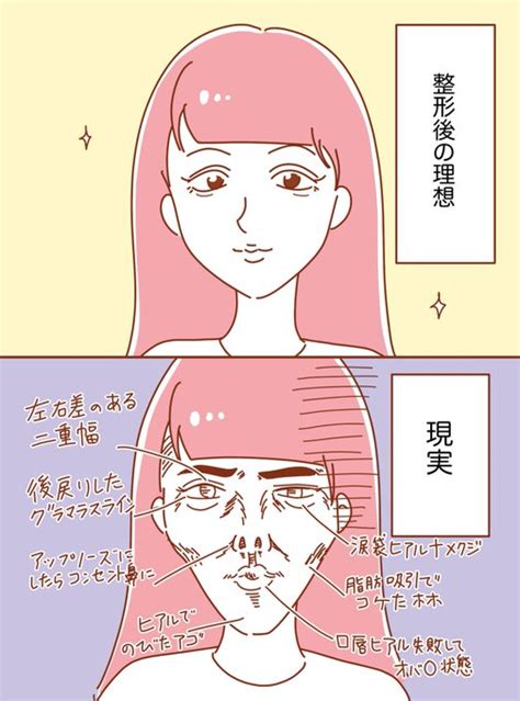 整形後の理想と現実😇 うみの韻花🌸電子書籍発売中！ さんのマンガ ツイコミ 仮