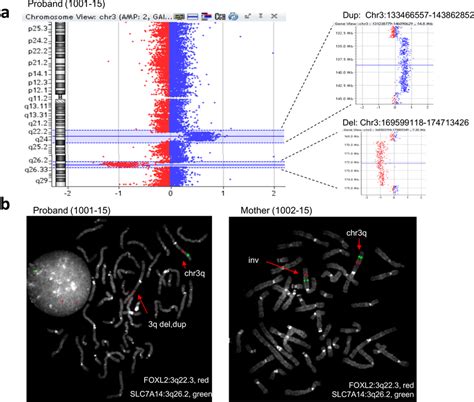 Case 1 Array Cgh And Fish Findings A Array Cgh Data Displaying De