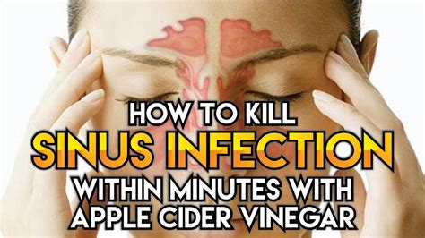 How To Kill Sinus Infection Within Minutes With Apple Cider Vinegar Youtube