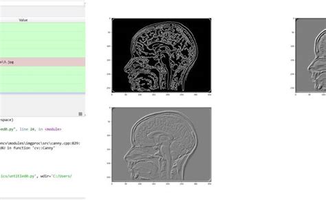 Laplacian Sobel And Canny Edge Detection Using Opencv And Python