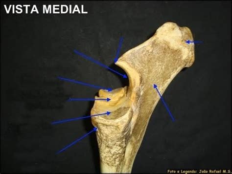 Juegos de Ciencias Juego de Rádio ulna vista medial proximal Cerebriti