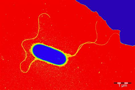 Centre for Enteric Diseases - NICD