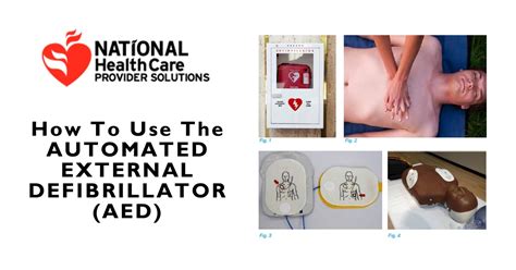 How To Use Automated External Defibrillator Guide