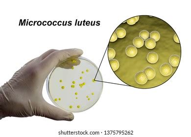 Micrococcus Luteus: Characteristics, Morphology, Diseases, 50% OFF