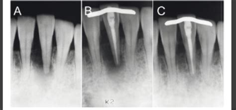 Clinical And Radiographic Diagnosis Of Periodontal Disease Lecture 2