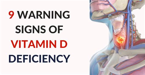 9 Warning Signs You Are Vitamin D Deficient And How To Fix Ita Mkdhealth