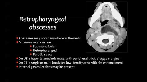 Pin By Aleksandra Stawik On Medyczne Head And Neck Medical