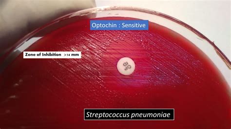 Optochin Susceptibility Test Principle Procedure Result And