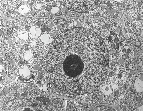 Plant Cell Showing Nucleus And Nucleolus Photograph by Dr Jeremy ...