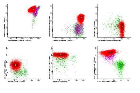 Mantle Cell Lymphoma MCL Hematomorphology A Databank Imagebank