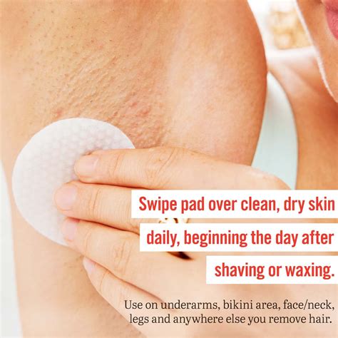 Buy First Aid Beauty Ingrown Hair Pads With Bha And Aha Daily Treatment Relieves Razor Burn