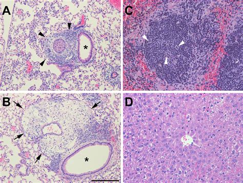 Photomicrographs Of Lung A And B Spleen C And Liver D