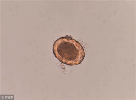 了解貓狗這6種常見體內寄生蟲，你以后在家也能科學的給寵物驅蟲