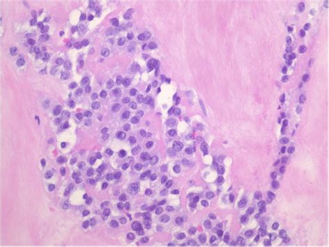 A 65 Year Old Man With Worsening Calf Pain JBJS Image Quiz