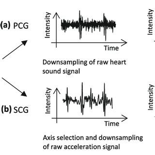 Construction Of The Phonocardiogram Pcg And Seismocardiogram Scg