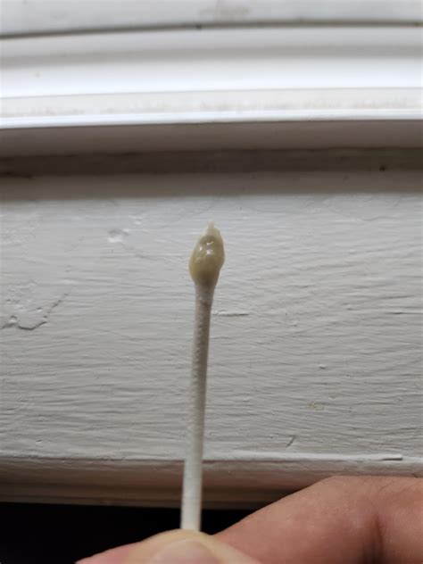 Snot like mucus coming out of my left ear??? Is this a trip to the ER