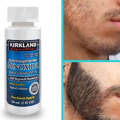 Minoxidil kirkland 🥇 | Posot Class