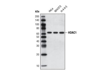 NuRD Complex Antibody Sampler Kit | Cell Signaling Technology