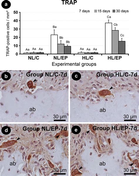 Immunolabeling For Trap In The Furcation Region Of The Lower First