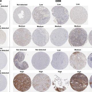 Lgals And Lgals Bp Protein Expression In Normal Brain Tissues And In